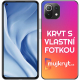 Kryt na Xiaomi Mi 11 Lite 5G NE s vlastní fotkou - Mujkryt.cz